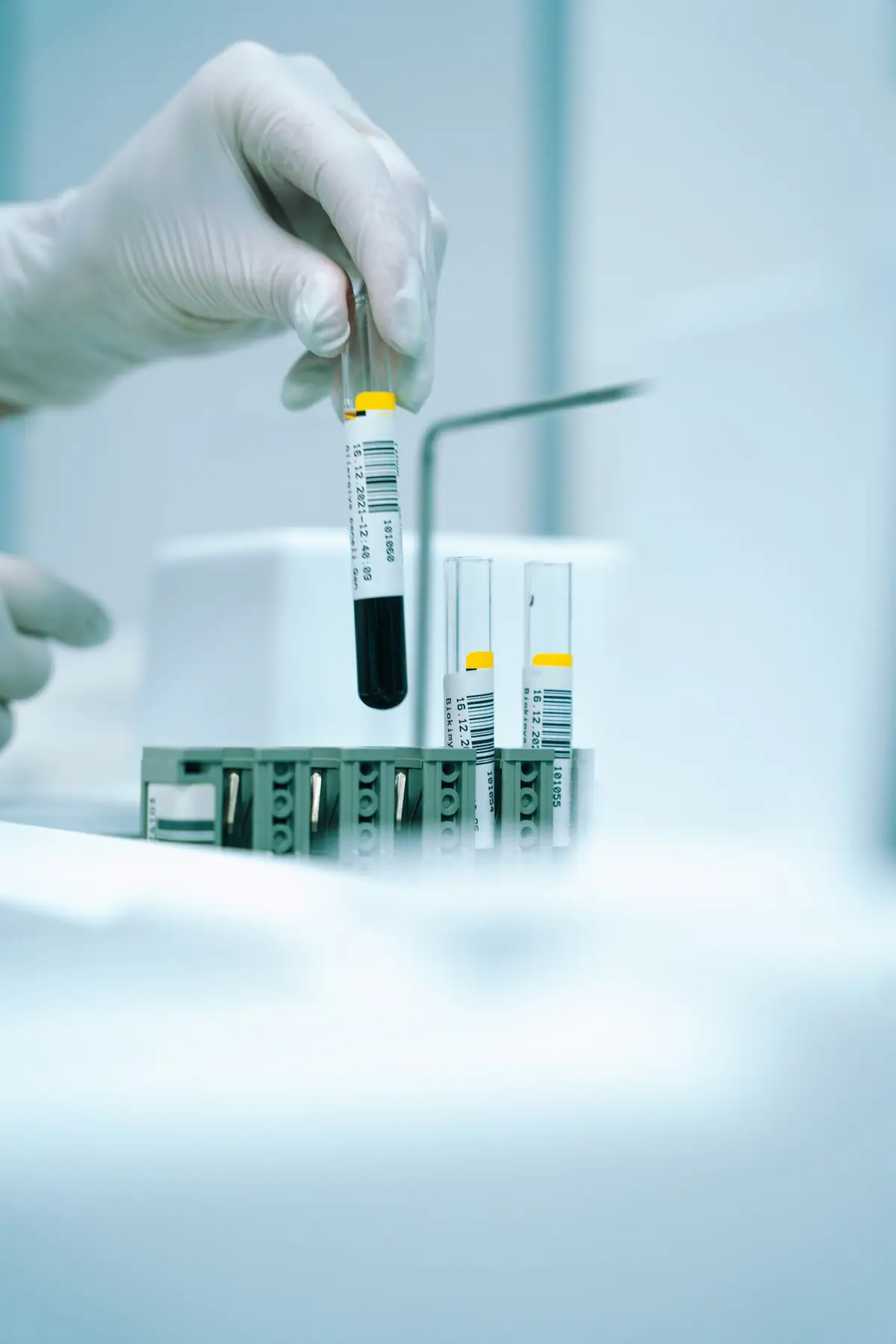 The 12 Longevity Biomarkers You Should Be Tracking (And