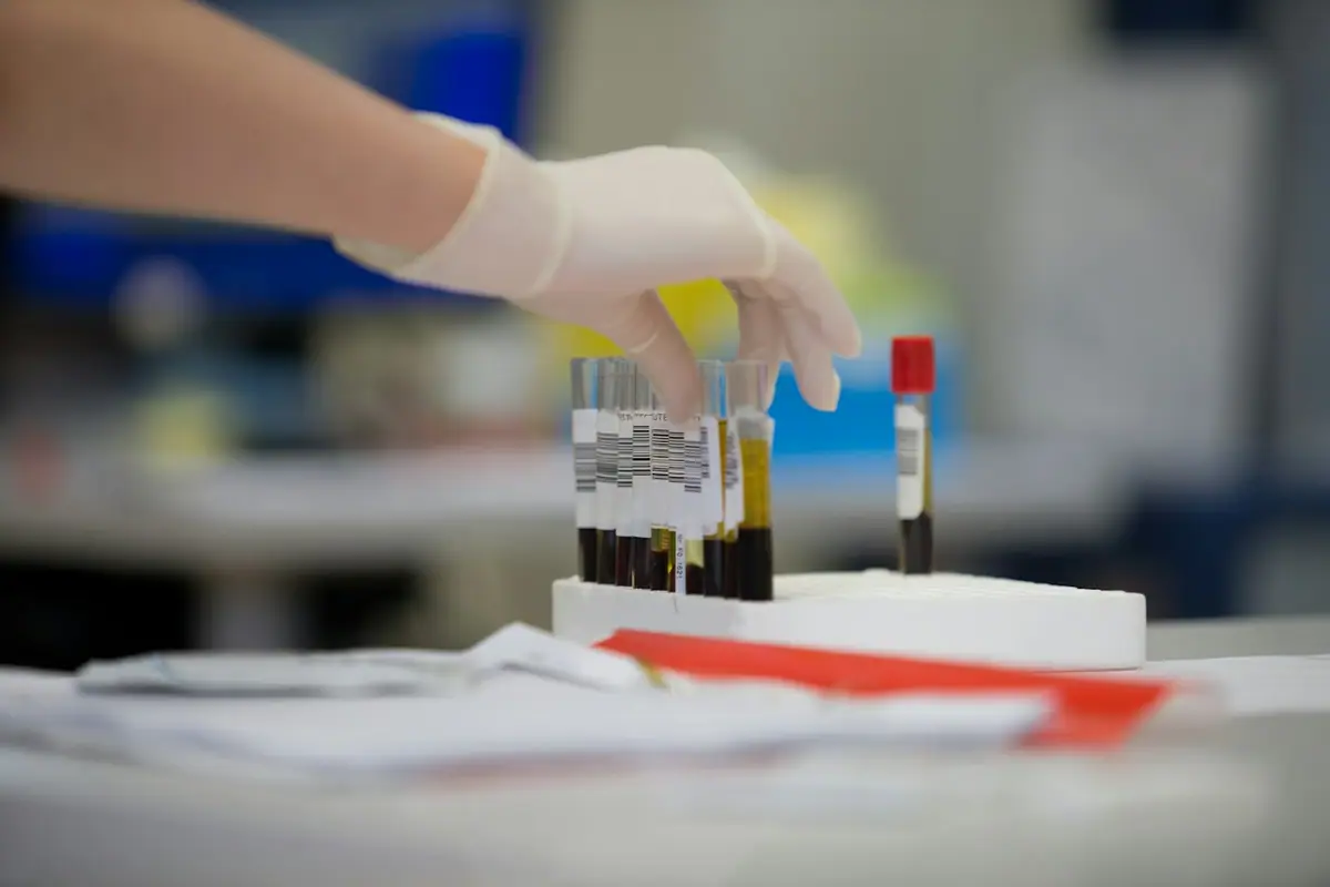 Best At-Home Blood Tests for Longevity